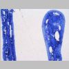Mucosa olfativa SF 04.jpg
